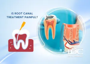 How Much Does Periodontitis Treatment Cost in Da Nang City, Vietnam?