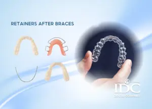 Are Removable Dentures a Good Option? A Tooth Replacement Solution for Missing Teeth