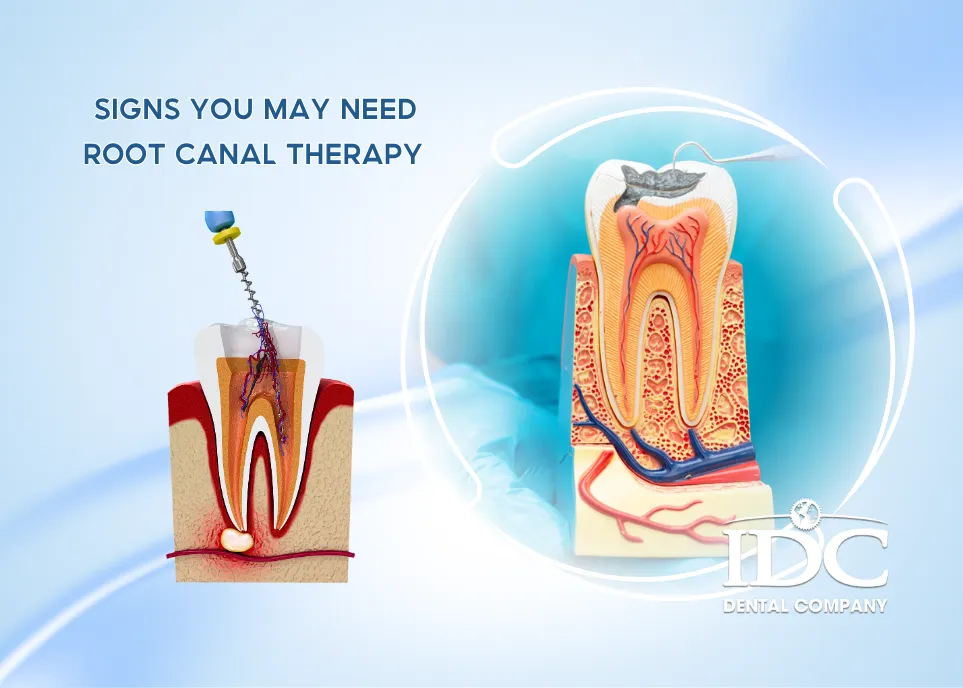 Signs You May Need Root Canal Therapy 11zon