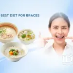 The Best Diet for Braces