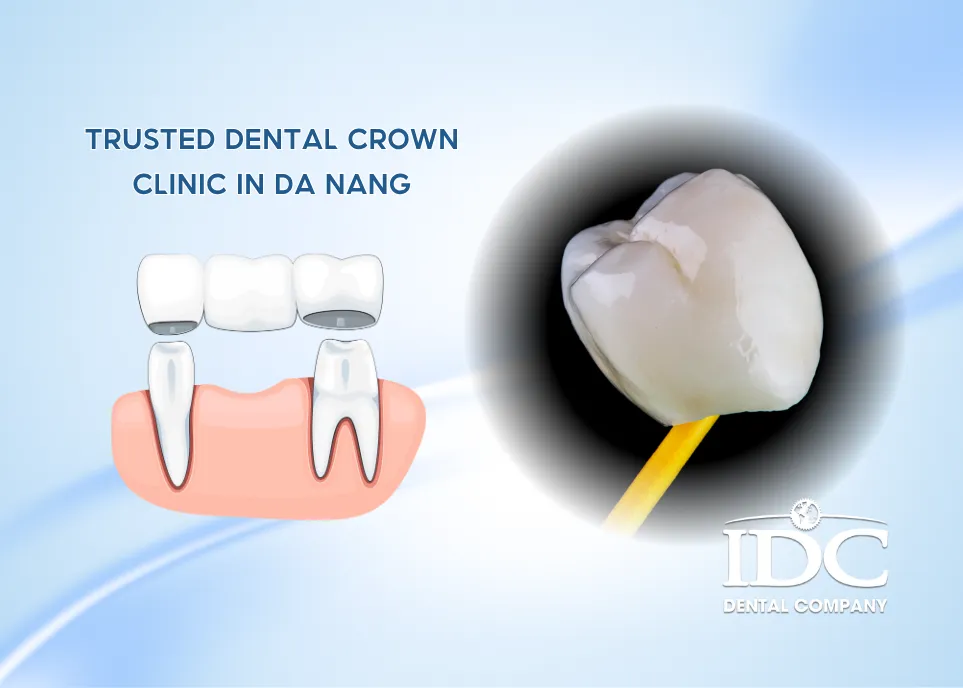 Trusted Dental Crown Clinic in Da Nang