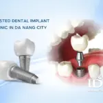 Trusted Dental Implant Clinic