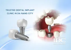 What If Something Goes Wrong After Dental Treatment Abroad? A Complete Guide for International Patients