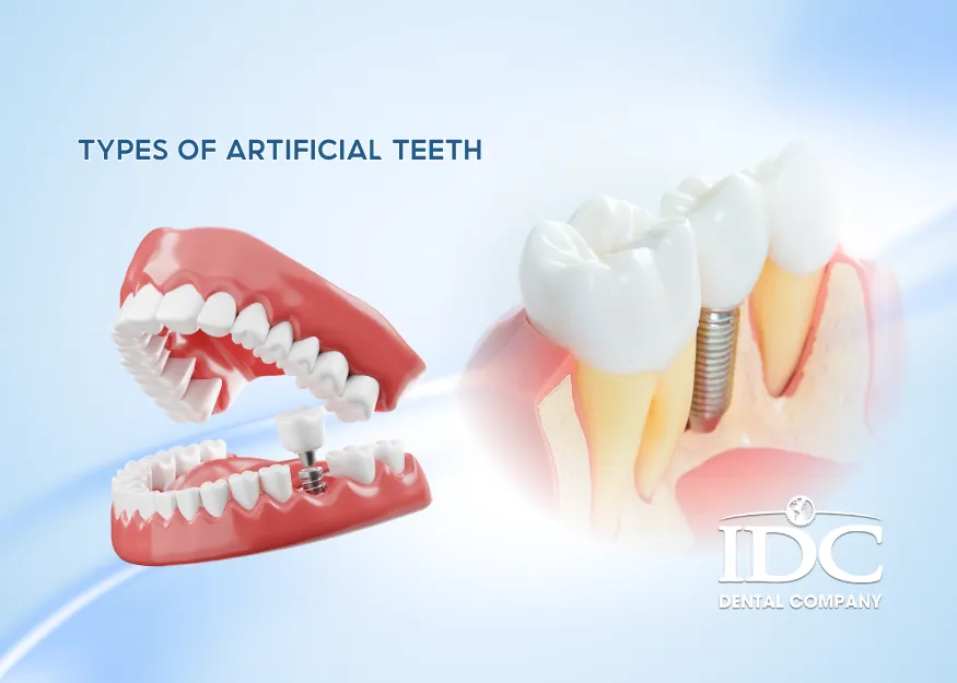 Types of Artificial Teeth