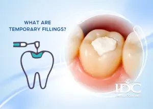 MegaGen Implants Reviews – Dental Implant in Da Nang