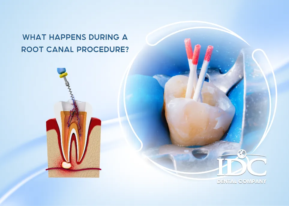 What Happens During a Root Canal Procedure?