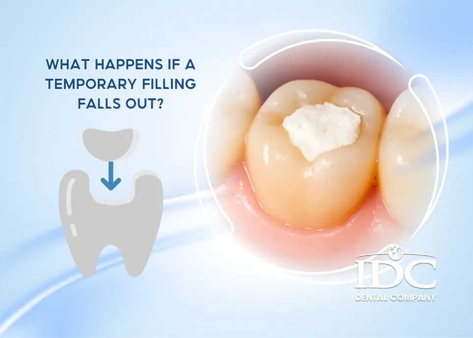 What Happens If a Temporary Filling Falls Out?