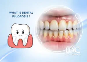 Is Root Canal Treatment Painful?