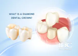 IDC DENTAL DA NANG — STRAIGHTFORWARD DENTAL KNOWLEDGE YOU SHOULD KNOW