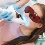 Who Is a Good Candidate for Teeth Whitening?