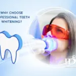 Why Choose Professional Teeth Whitening?