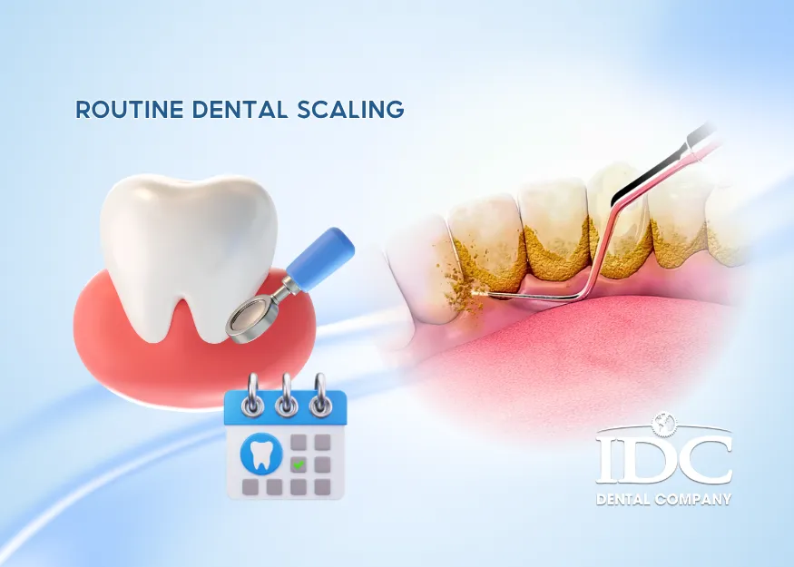 Why Routine Dental Scaling Is Essential for Healthy Teeth and Gums 11zon