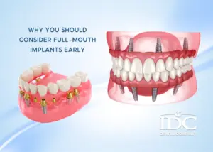 IDC DENTAL DA NANG — STRAIGHTFORWARD DENTAL KNOWLEDGE YOU SHOULD KNOW