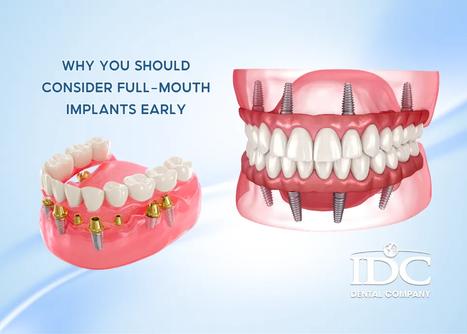 Why You Should Consider Full Mouth Implants Early 11zon