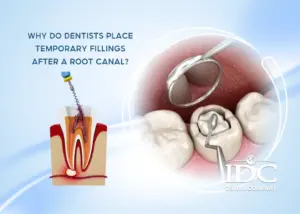 Where can I get same-day dental crowns in Da Nang City?