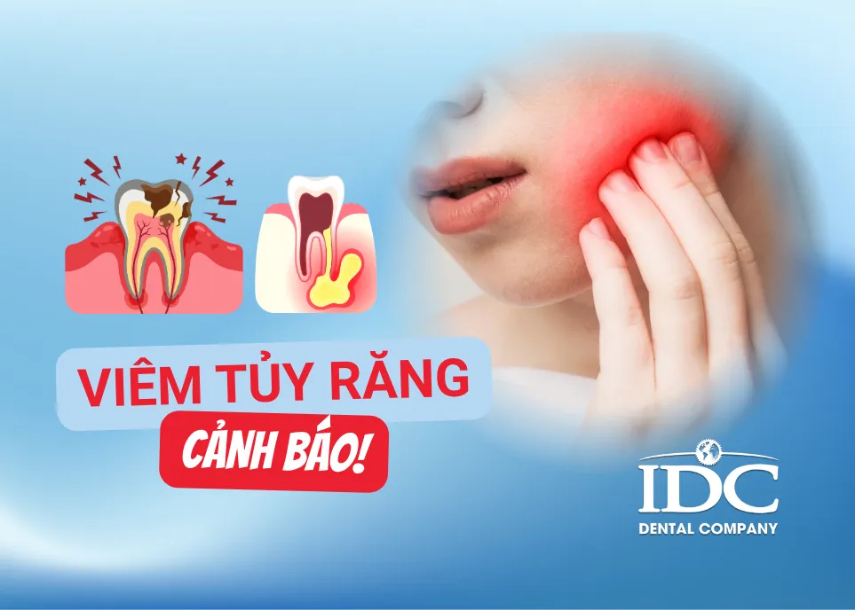 Những biến chứng nguy hiểm khi bị viêm tủy răng