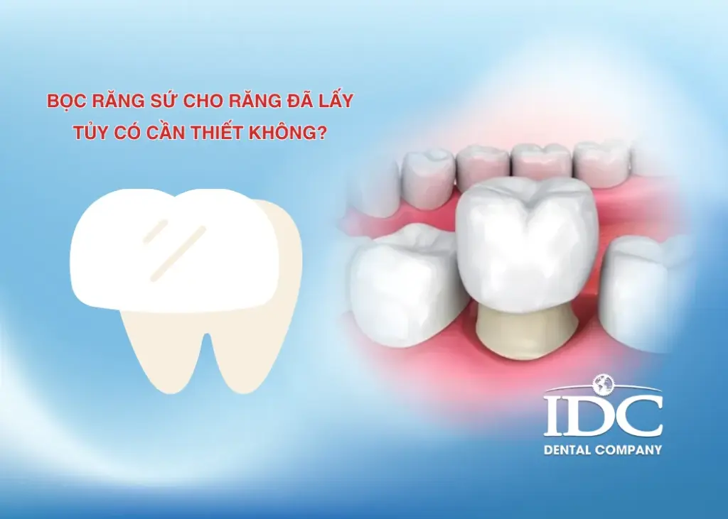 Bọc răng sứ cho răng đã lấy tủy có cần thiết không?