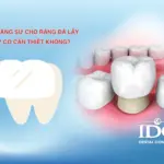 Bọc răng sứ cho răng đã lấy tủy có cần thiết không?
