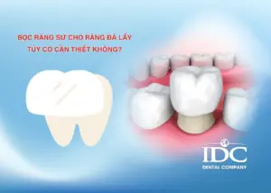 Răng sứ pha lê là gì? Ưu điểm, nhược điểm và có nên lựa chọn?