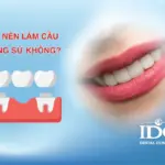 co nen lam cau rang su khong 11zon