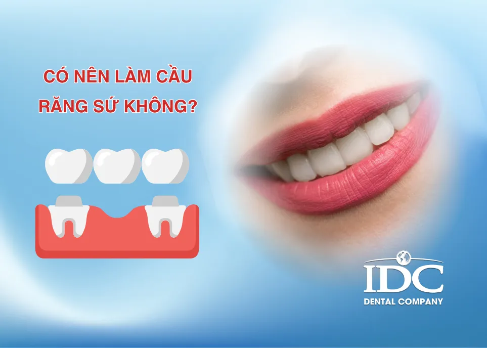 Có nên làm cầu răng sứ không?