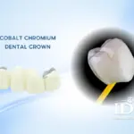 cobalt chromium dental crown
