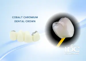 What If Something Goes Wrong After Dental Treatment Abroad? A Complete Guide for International Patients