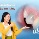 dau hieu cua viem tuy rang ban dung nen chu quan