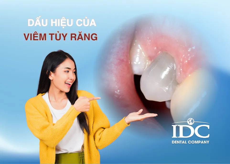 dau hieu cua viem tuy rang ban dung nen chu quan