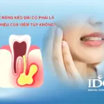 Đau răng kéo dài có phải là dấu hiệu của viêm tủy không?