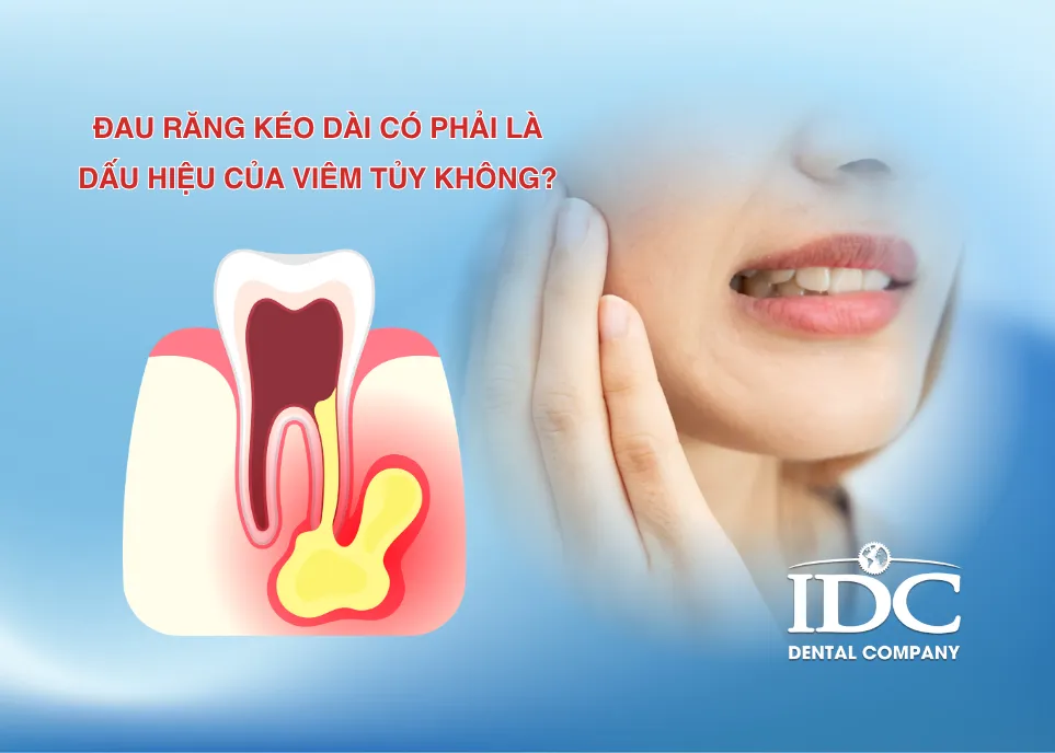 dau tuy rang keo dai co phai dau hieu cua viem tuy rang