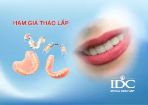 Mão răng sứ là gì? Cấu tạo, ưu nhược điểm và khi nào nên làm