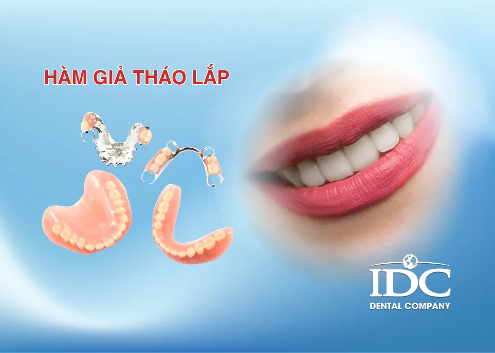 Hàm giả tháo lắp có tốt không?