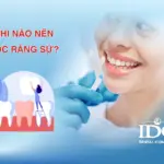 khi nao nen boc rang su 11zon