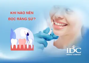 Răng ê buốt kéo dài có cần điều trị tủy răng không?