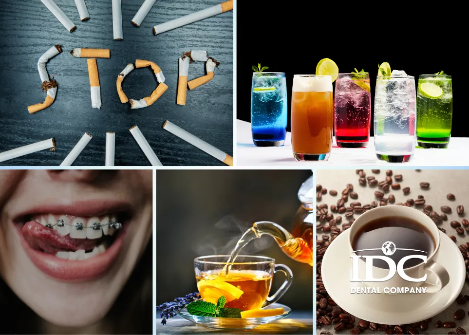 Những ai có nguy cơ tích tụ vôi răng cao?