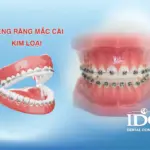 nieng rang mac cai kim loai 11zon