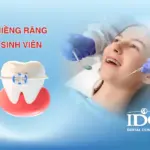 niềng răng sinh viên