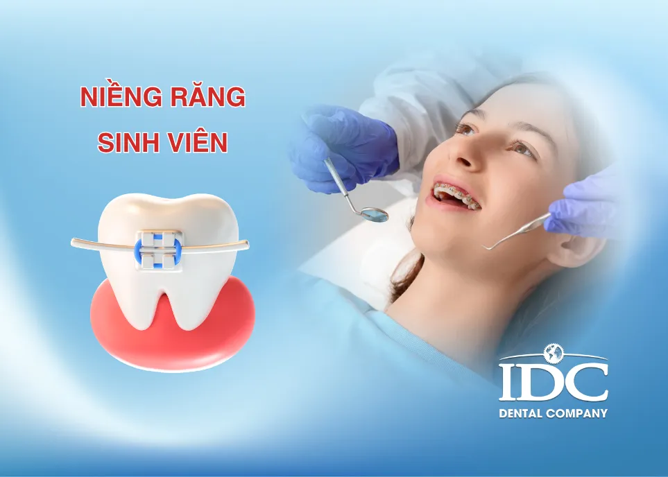 niềng răng sinh viên