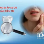 rang bi ap xe co can dieu tri