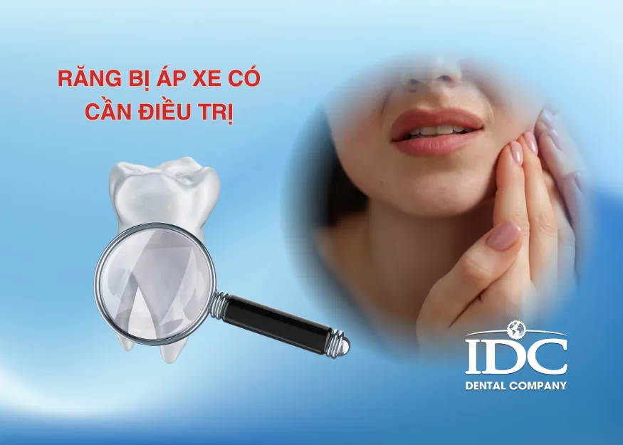 Răng bị áp xe có cần điều trị tủy không?