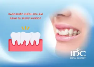 Hàm giả tháo lắp có tốt không? Giải pháp cho người mất răng