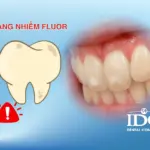 Răng nhiễm fluor có tự hết không?