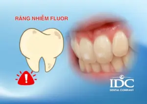 Nha khoa niềng răng tại Đà Nẵng: Các phương pháp và thời gian điều trị
