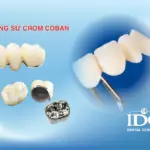 rang su Crom Coban 11zon