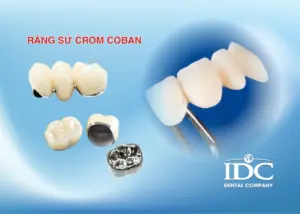 Có nên niềng răng cho trẻ 11 tuổi không? Thời điểm vàng hay không?