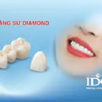rang su Diamond 11zon