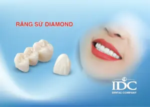 Có nên niềng răng cho trẻ 11 tuổi không? Thời điểm vàng hay không?