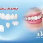 Răng toàn sứ Emax là gì?