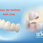 rang su khong kim loai